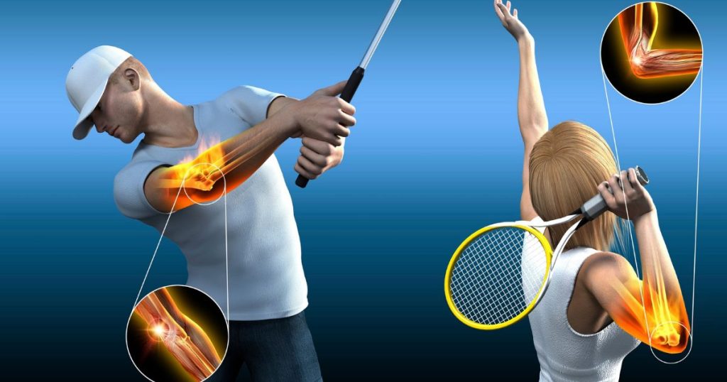 Tennis Elbow vs Golf Elbow